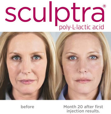 Scultra Before and After